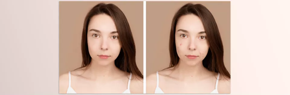 FacePro Plugin - Sample 2